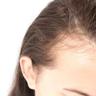 女性常掉发或与这4种疾病相关