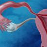 子宫内膜厚会影响怀孕吗