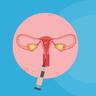 盆腔粘连影响怀孕吗