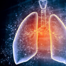 怎样避免肺炎的发生 怎么预防肺炎的发生