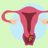 慢性宫颈炎影响怀孕吗